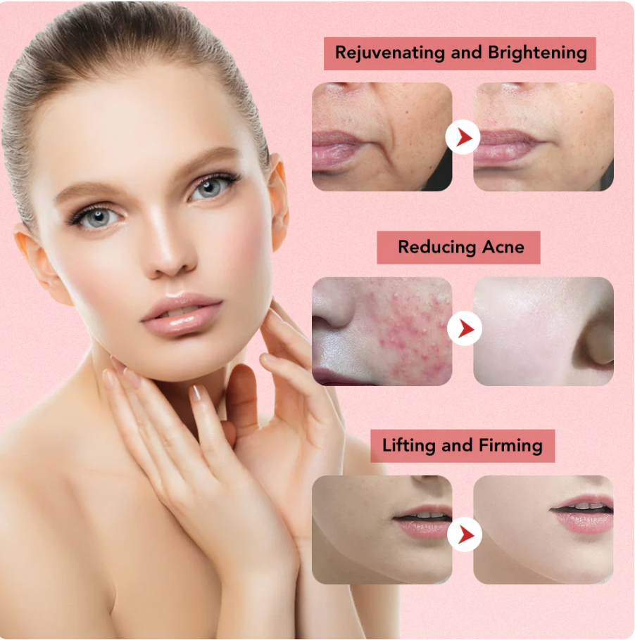 Masajeador facial con frío y calor antiarrugas